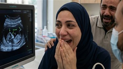 حملت لأول مرة وأنا عندي 45 سنة